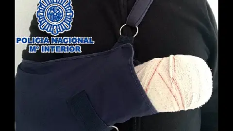 El agente herido