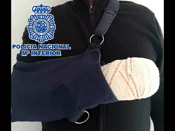 El agente herido